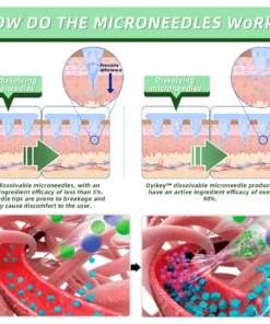 𝑳𝑶𝑽𝑰𝑳𝑫𝑺™ 𝑺𝑴𝑮𝑻-𝑮𝑳𝑷-𝟏 𝑵𝒂𝒏𝒐 𝑴𝒊𝒄𝒓𝒐𝒏𝒆𝒆𝒅𝒍𝒆 𝑷𝒂𝒕𝒄𝒉