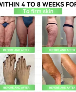 𝑩𝒖𝐢𝒍𝒅𝑳𝒆𝐚𝒇® GL𝐏-1 8-𝒊𝒏-1 𝙁𝙞𝙩 & 𝙑𝙞𝙩𝙖𝙡 𝖮𝗋𝖺𝗅 𝙎𝙤𝙡𝙪𝙩𝙞𝙤𝙣