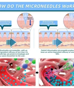 Slimoly® NIDDK-𝑻𝒊𝒓𝒛𝒆𝒑𝒂𝒕𝒊𝒅𝒆 Nano 𝑴𝒊𝒄𝒓𝒐𝒏𝒆𝒆𝒅𝒍𝒆 𝑷𝒂𝒕𝒄𝒉