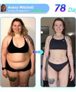 Slimoly® NIDDK-𝑻𝒊𝒓𝒛𝒆𝒑𝒂𝒕𝒊𝒅𝒆 Nano 𝑴𝒊𝒄𝒓𝒐𝒏𝒆𝒆𝒅𝒍𝒆 𝑷𝒂𝒕𝒄𝒉