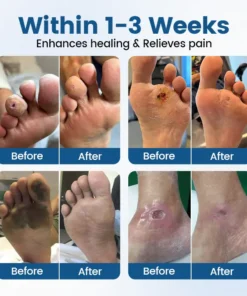 Timilk® AngioVita Diabetic Care Spray