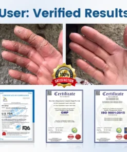 Timilk® AngioVita Diabetic Care Spray