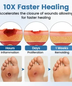 Timilk® AngioVita Diabetic Care Spray