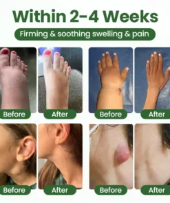 Timilk® BodyRelief Circulation Cream — 48-Hour Visible Swelling Relief