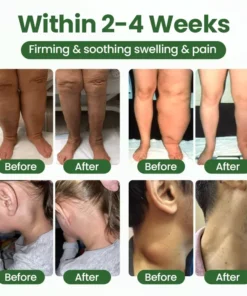 Timilk® BodyRelief Circulation Cream — 48-Hour Visible Swelling Relief