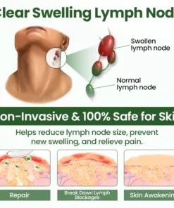 Timilk® BodyRelief Circulation Cream — 48-Hour Visible Swelling Relief