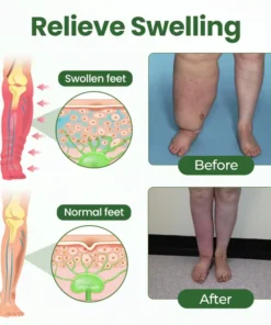 Timilk® BodyRelief Circulation Cream — 48-Hour Visible Swelling Relief