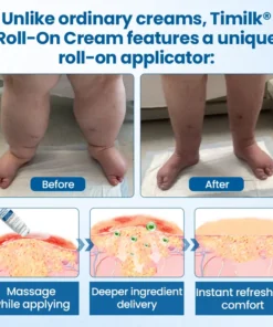 Timilk® Lymphora Wiwu Relief Roll-Lori