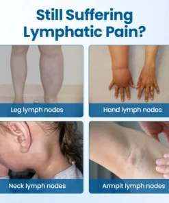 Timilk® Lymphora Wiwu Relief Roll-Lori