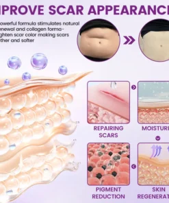 Timilk® ScarVanisher Scar Gel جو 2 ہفتوں میں نشانات اور اسٹریچ مارکس کو واضح طور پر کم کرتا ہے