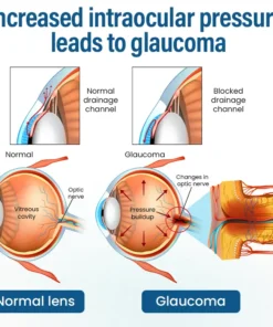 Timilk® VisionReborn Nano Eye Drops