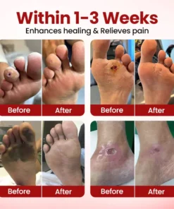 Timilk® VitaGluco ذیابیطس کیئر کریم