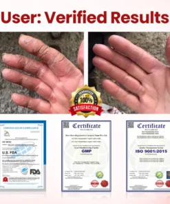 Timilk® VitaGluco ذیابیطس کیئر کریم