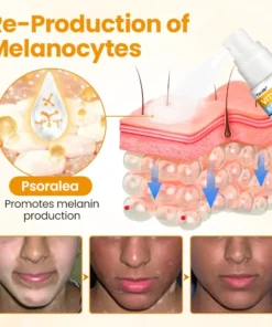 Chwistrell Cyflym Timilk® VitiGone — Ail-bigmentiad 2–3 Wythnos gydag OTDS