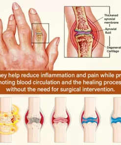 Timilk® VenomEase Joint Cream