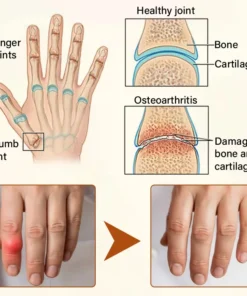 Timilk® VenomEase Joint Cream