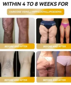 𝐂𝐙𝐓𝐈𝐂𝐋𝐄® 𝐌𝐚𝐠𝐧𝐞𝐭𝐢𝐜 𝐄𝐧𝐞𝐫𝐠𝐲 𝐆𝐞-𝐒𝐭𝐨𝐧𝐞 𝐌𝐚𝐩𝐥𝐞 𝐄𝐚𝐫𝐫𝐢𝐧𝐠𝐬