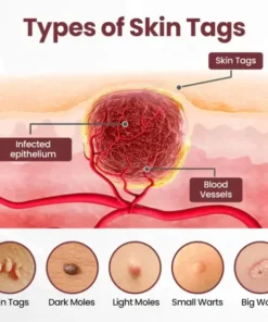 Biancat® KeraErase Dual-Action Renewal Cream