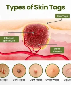 Biancat® MagneErase Renewal Cream