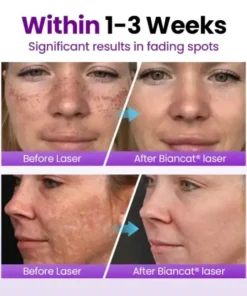 Biancat® SpotErase Probiotic Shield Serum