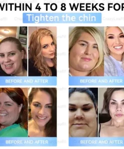 BuildLeaf® Tirzepatide Slimming & Health Nano Microneedle Patch