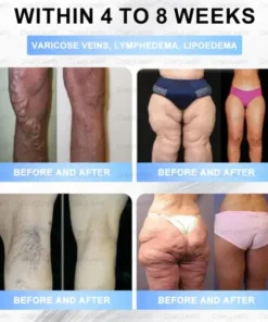 BuildLeaf® Tirzepatide Slimming & Health Nano Microneedle Patch