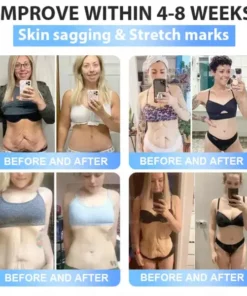 BuildLeaf® Tirzepatide Slimming & Health Nano Microneedle Patch