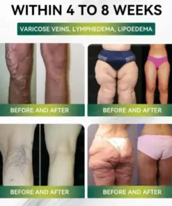 Buildleaf® SMGT-GLP-1 Nano Microneedle Patch with Collagen Peptides &Matrixyl 3000