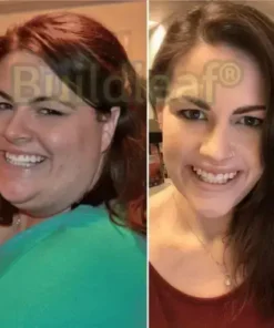 Buildleaf® SMGT-GLP-1 Nano Microneedle Patch with Collagen Peptides &Matrixyl 3000