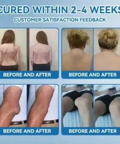 Croaie® ʙ.ᴘ.ᴄ-157 Joint Healing Cream