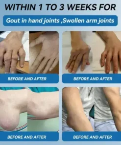 Croaie® ʙ.ᴘ.ᴄ-157 Joint Healing Cream