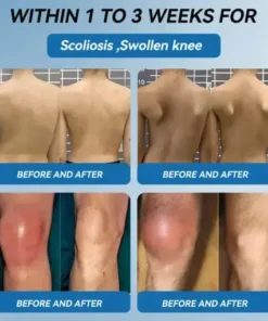 Croaie® ʙ.ᴘ.ᴄ-157 Joint Healing Cream