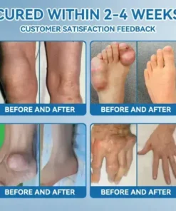 Croaie® ʙ.ᴘ.ᴄ-157 Joint Healing Cream