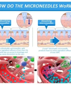 Croaie® Nano Microneedle Patch with SMGT-GLP-1 & Matrixyl 3000