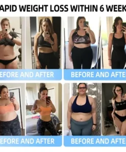 Croaie® Nano Microneedle Patch with SMGT-GLP-1 & Matrixyl 3000