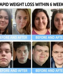 Croaie® Nano Microneedle Patch with SMGT-GLP-1 & Matrixyl 3000