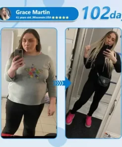 Croaie® Nano Microneedle Patch with SMGT-GLP-1 & Matrixyl 3000