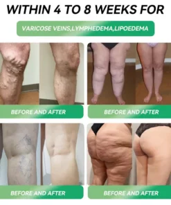 Croaie® Telportide Oral Solution, GIP and GLP-1 Dual-Action Weight Loss Solution