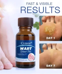 Cvreoz® Wart Eraser Pro
