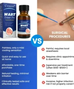 Cvreoz® Wart Eraser Pro