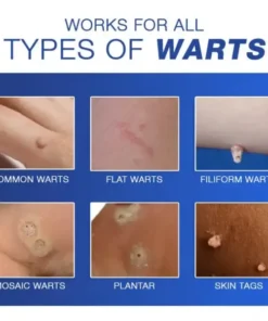 Cvreoz® Wart Eraser Pro