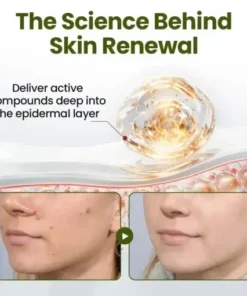 LOVILDS® MagneErase Renewal Cream