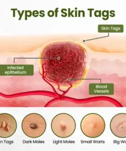 LOVILDS® MagneErase Renewal Cream