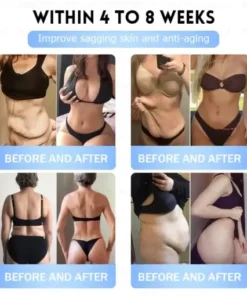 𝐵uil𝗱𝐿ea𝐟®𝑮𝐋𝑃-1 Slim & Firm 𝑁ano 𝑀icroneedle 𝑃atch