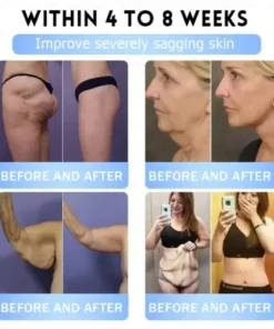 𝐵uil𝗱𝐿ea𝐟®𝑮𝐋𝑃-1 Slim & Firm 𝑁ano 𝑀icroneedle 𝑃atch