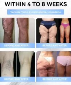 𝐵uil𝗱𝐿ea𝐟®𝑮𝐋𝑃-1 Slim & Firm 𝑁ano 𝑀icroneedle 𝑃atch