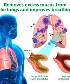 𝗟𝗲𝗿𝗰𝗲𝗮™ 𝗠𝘂𝗹𝗹𝗲𝗶𝗻 𝗖𝗹𝗲𝗮𝗿 𝗟𝘂𝗻𝗴 𝗥𝗲𝗽𝗮𝗶𝗿 𝗖𝗿𝗲𝗮𝗺