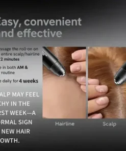 BQYOOM™ Professional Anti-Hair Loss Roll-On