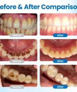 Biancat® NanoHAP Tooth Defense Serum