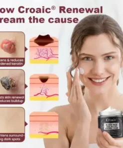 Croaie® KeraErase RICEDUAL-ACTION RENEWAL CREAM